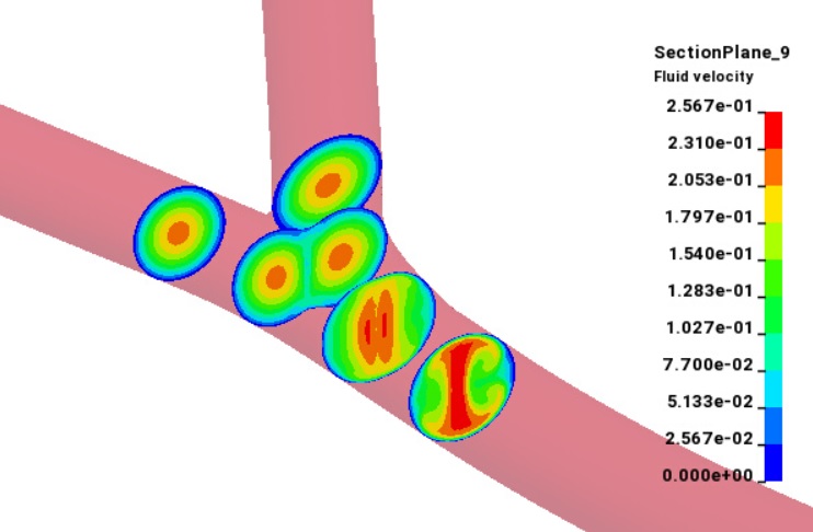 venacava_exercise_section.jpg